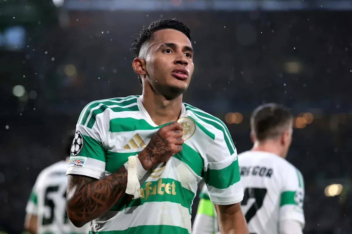 Player celebrating in Celtic FC kit during match