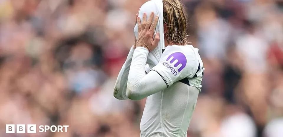 Player covering face with shirt during match