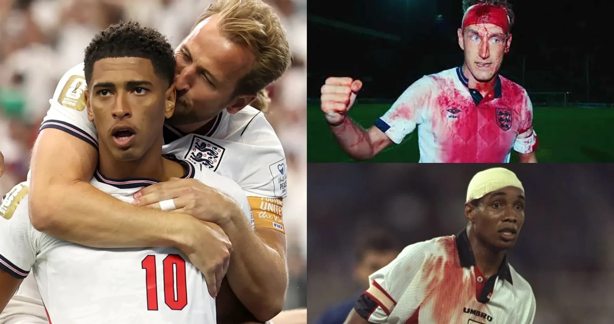 Three football players with bloodied shirts in action