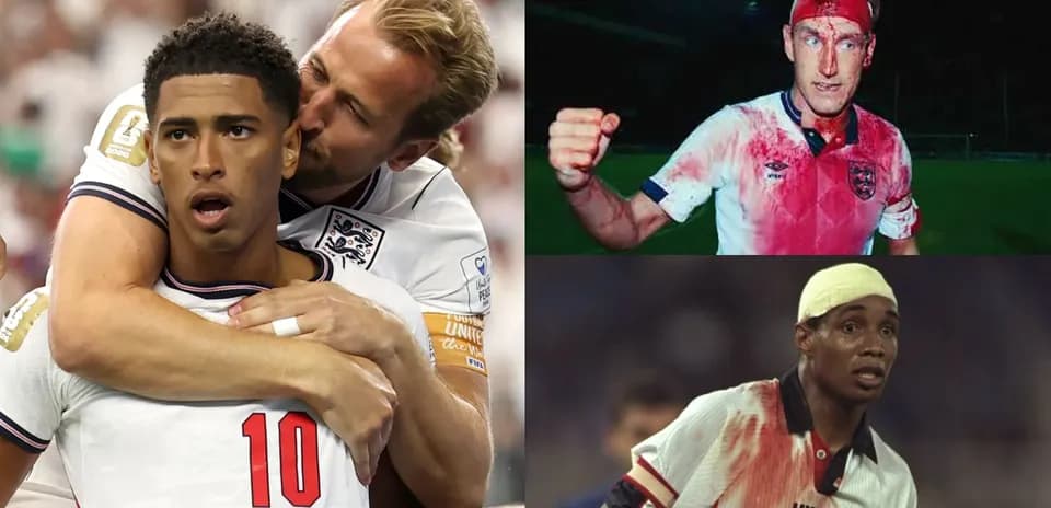 Three football players with bloodied shirts in action
